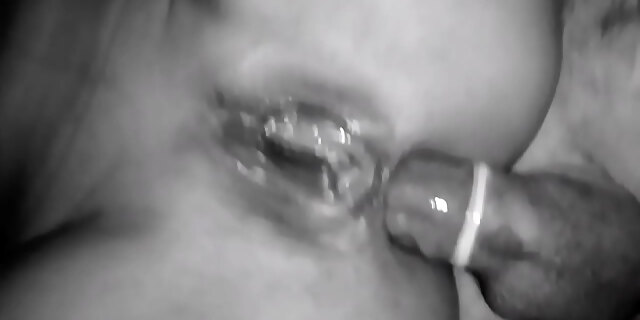 anal